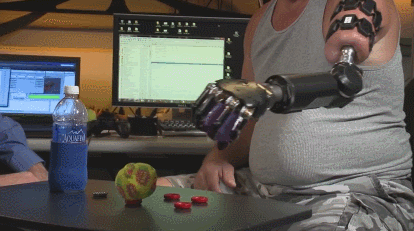 myo prosthetic arm