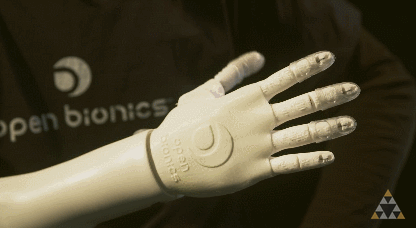 Open Bionics