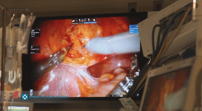 da vinci <a rel='nofollow' href='http://www.gadgetify.com/tag/robot/'>robot</a> surgeon