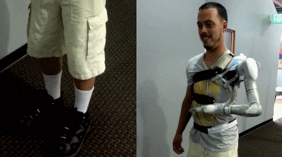 LUKE Advanced Prosthetic Arm