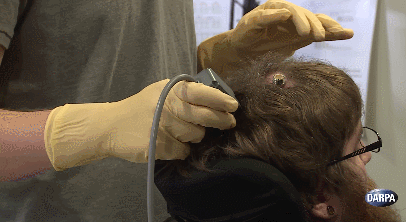 brain-controlled-robotic-arm